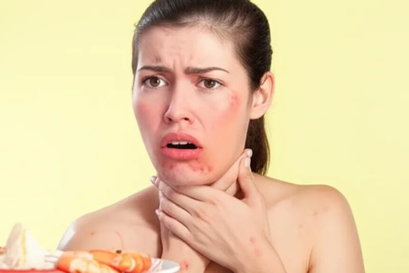 Ets al·lèrgic a certs aliments? (Al·lèrgia alimentària) Descobrim exactament això!