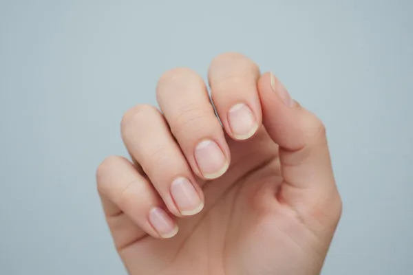 Ți se umflă unghiile cât o lingură? Hai să vorbim despre Nail Clubbing!