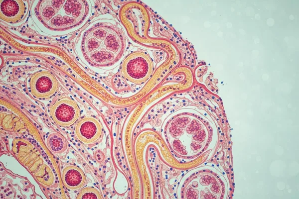 Ŋutinya si le megbe na ayiku: (Renal Cortex) ye nye míaƒe ŋutilã!