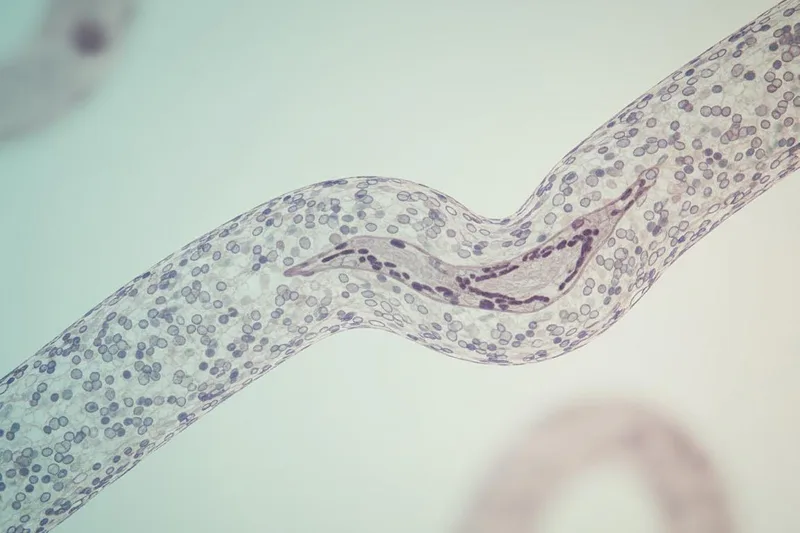 TEVAR operace pro onemocnění hrudní aorty? (Thoracic Endovascular Aorta Repair) Pochopme to jednoduše