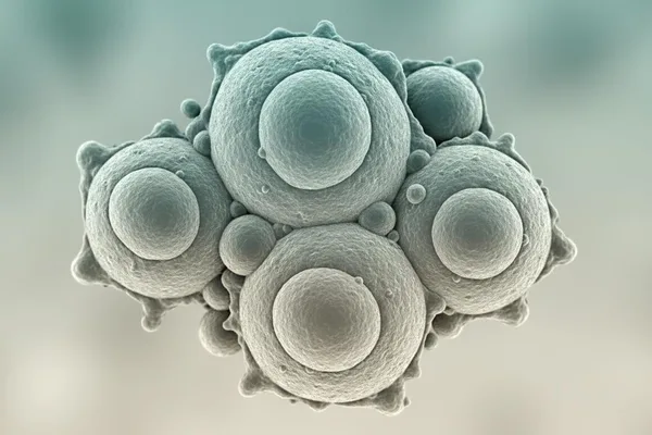කාසිනෝමා (Carcinoma) ගැන හරියටම දැනගමුද? ඔයාටත් මේ ප්රශ්න තියෙනවද?