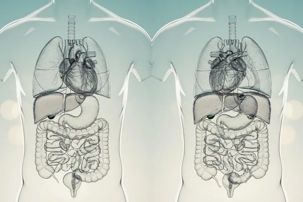ڇا توهان جا عضوا توهان جي جسم جي ٻئي پاسي واقع آهن؟ (Situs Inversus) - اچو ته ان بابت ڳالهايون!