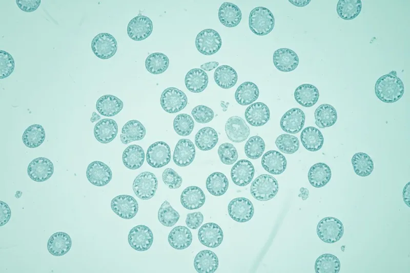 Litte wy op in ienfâldige manier leare oer DLBCL (Diffuse Large B-Cell Lymphoma) kanker.