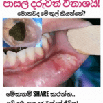 තූල් (Thul) පාවිච්චි කරන එකේ මාරාන්තික අනතුර සහ මුඛ පිළිකා අවදානම (Oral Cancer Risk)