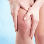 Diclofenac Gel Uses in Sinhala: හන්දිපත් සහ මස්පිඬු වේදනාවට ගාන ඩයික්ලොෆෙනැක් ජෙල් (Diclofenac Gel) ආරක්ෂිතව පාවිච්චි කරන හැටි