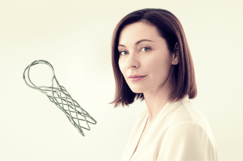 ස්ටෙන්ට් (Stent) එකක් කියන්නේ මොකක්ද? ඔයාත් මේ ගැන දැනුවත් වෙන්න!