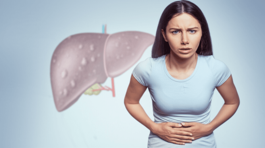 ඔයාගේ අක්මාවෙත් මේදය වැඩිද? අලුත් නමින් එන අක්මාවේ තෙල් තැන්පත් වීමේ රෝගය (Steatotic Liver Disease) ගැන දැනගමු!