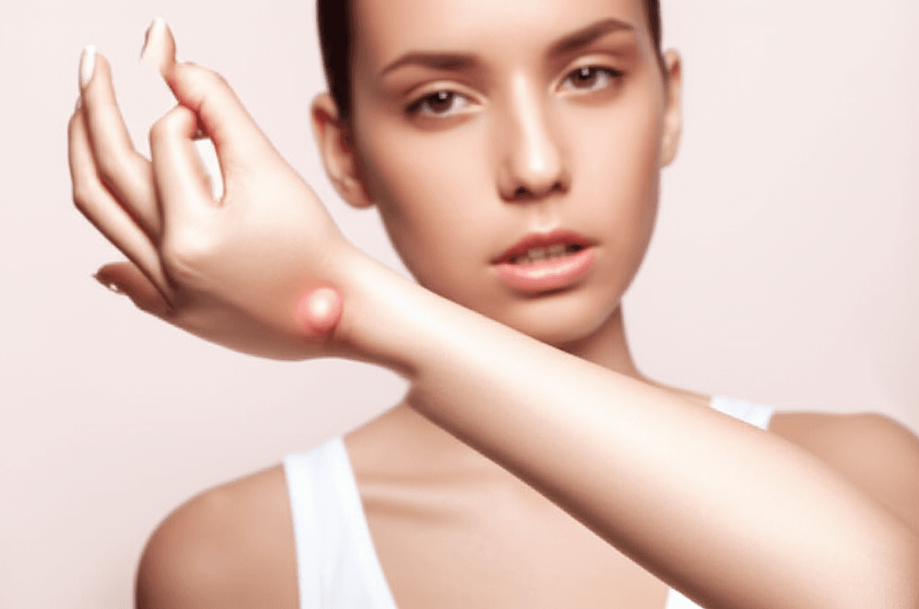 ඔයාගේ අතේ මැනික් කටුව උඩත් අමුතු අස්ථි ගැටයක් ඇවිල්ලද? (Carpal Boss) අපි මේ ගැන කතා කරමු!