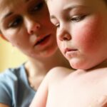 ස්කාර්ලට් ෆීවර් (Scarlet Fever in Sinhala): ඔයාගේ දරුවාගේ ඇඟේ රතු පලු දාලා, උණත් එක්ක දිවේ රතු බිබිලි ඇවිත්ද?