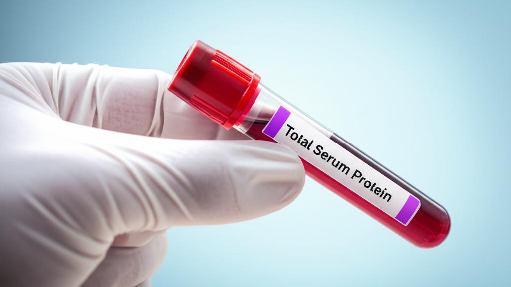 Let's simply talk about the Total Serum Protein Test, which checks the protein levels in the blood!