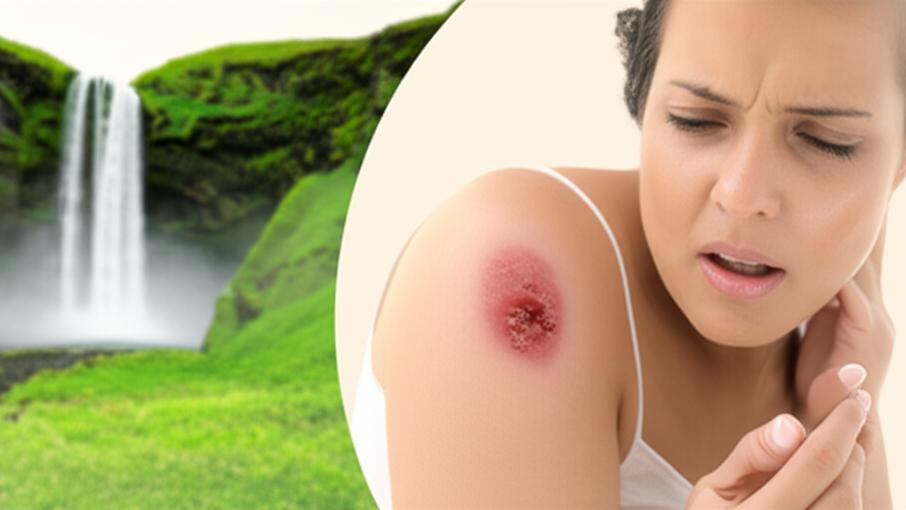 Does Horsefly bite hurt? Let's find out for sure!