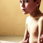 Fibrodysplasia Ossificans Progressiva (FOP) - Qhuruqha jilañ mayjt’ayiri usu
