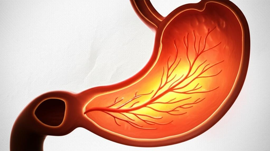What is Gastrin? Does it affect your stomach problems?
