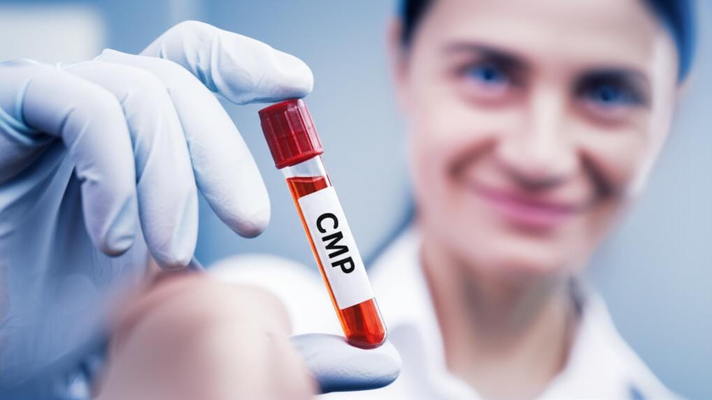 Shall we talk about the CMP test (Comprehensive Metabolic Panel) to know the secrets of your body's health?