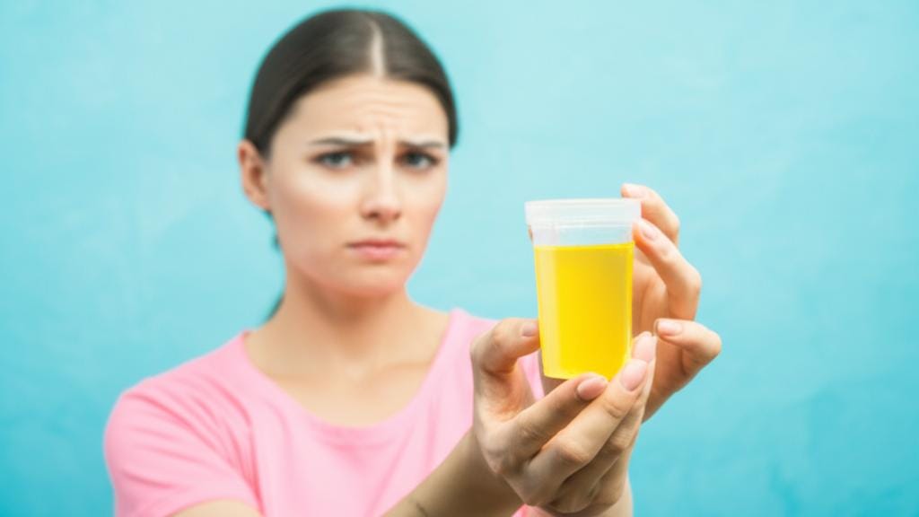 ඔයාගේ මුත්රා සාම්පලයක් 'කල්චර්' කරන්නේ ඇයි? (Urine Culture) අපි මේ ගැන සවිස්තරව කතා කරමු! ඔයාගේ මුත්රා සාම්පලයක් ‘කල්චර්’ කරන්නේ ඇයි? (Urine Culture) අපි මේ ගැන සවිස්තරව කතා කරමු!