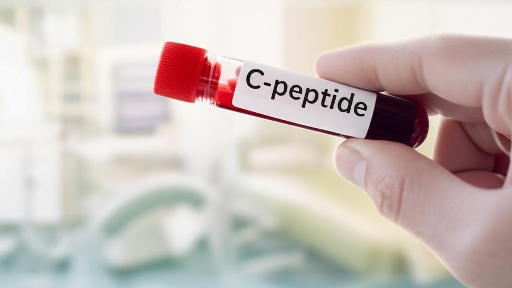 Does your body produce insulin? Let's find out with the C-peptide test!