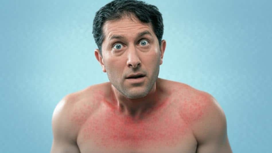 ඇඟට නිතරම අමුතු අමාරු එනවද? මේ `(Systemic Mastocytosis)` ගැන හරියටම දැනගමු!