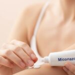 Miconazole Cream Sinhala: සමේ දිලීර ආසාදනවලට ආලේප කරන මයිකොනසෝල් (Miconazole Nitrate) ක්‍රීම් එක ගැන දැනගත යුතුම දේ