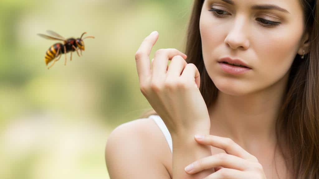 Let's learn about a wasp/hornet attack: What to do about the venom? (Wasp/Hornet Sting)