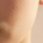 موی ولوس چیست؟ همه چیز درباره پرز هلو و موهای کرکی بدن