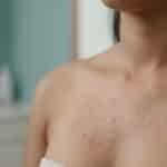 ඔයාගෙත් පියයුරු වල දදයක් (Breast Eczema) ඇවිල්ලද? අපි මේ ගැන හරියටම දැනගමු!