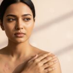 Polymorphous Light Eruption (PMLE): Causes, Symptoms, and Treatments
