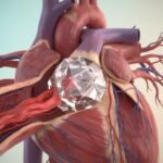 شوک انسدادی چیست؟ علائم، علل و راهنمای درمان اورژانسی