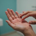 راهنمای جامع کچلی دست (Tinea Manuum): علائم، علل و روش‌های درمان خانگی و پزشکی